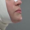 Rehabilitation